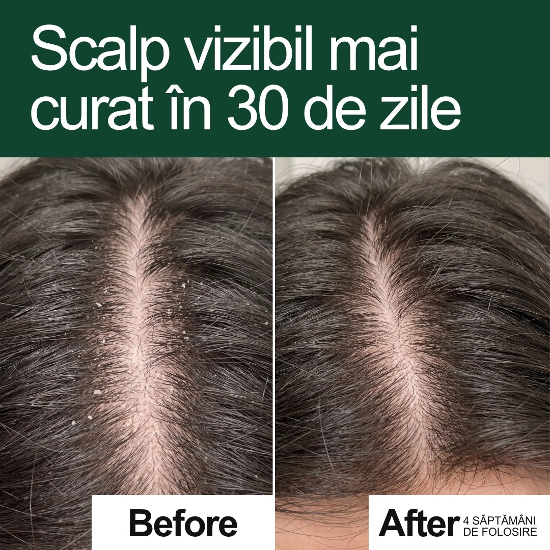 Înainte și după + recenzii