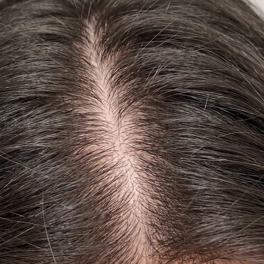 Cărare pe creștet, scalp fotografiat de aproape